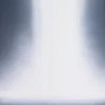 ウォーターフォール